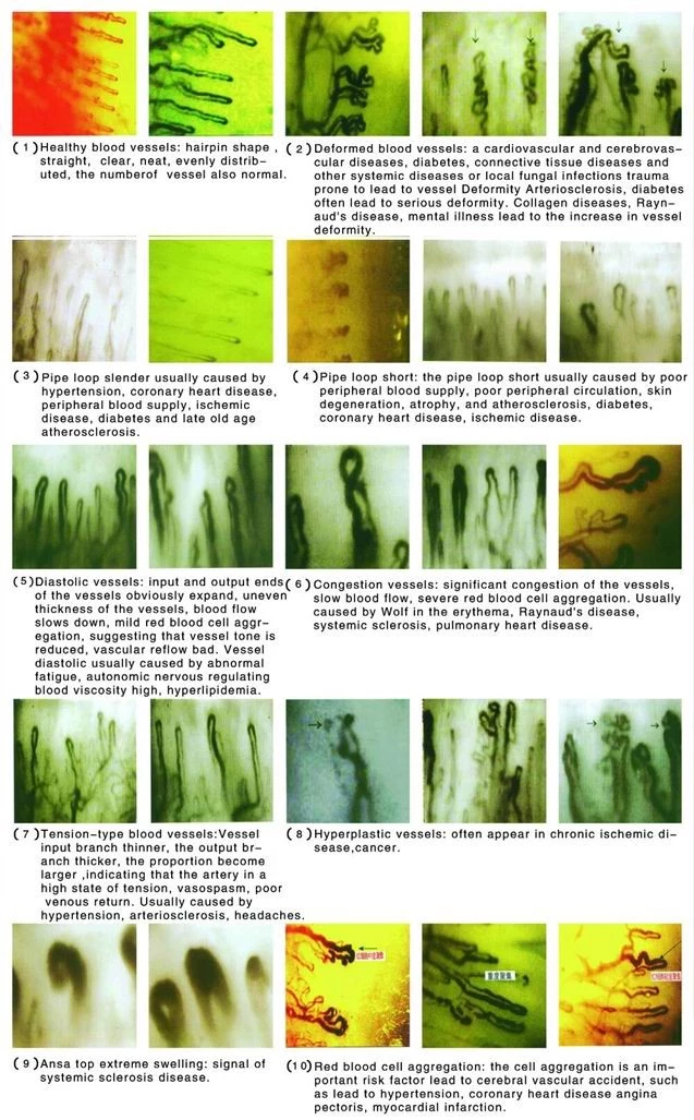 microcirculation (1).png