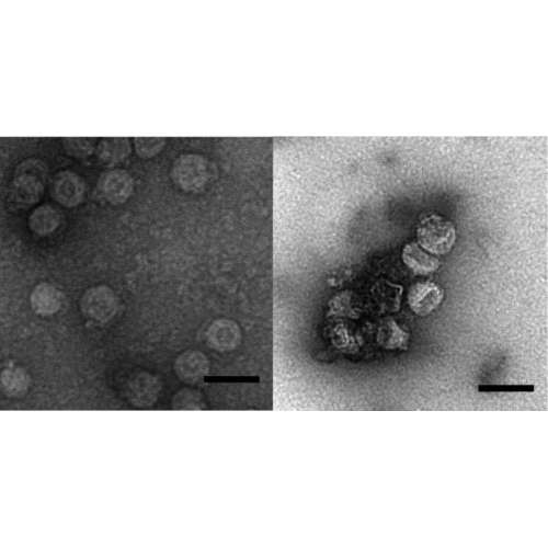 La tecnica di trattamento delle acque standard rimuove e inattiva un virus avvolto