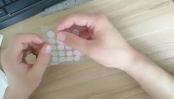 Acne patch