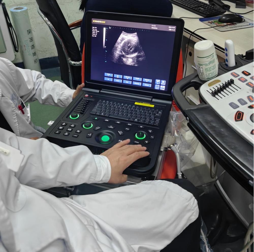 Hospital Ultrasound Application Scenarios