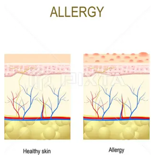 Prevention and response to allergy in beauty treatment