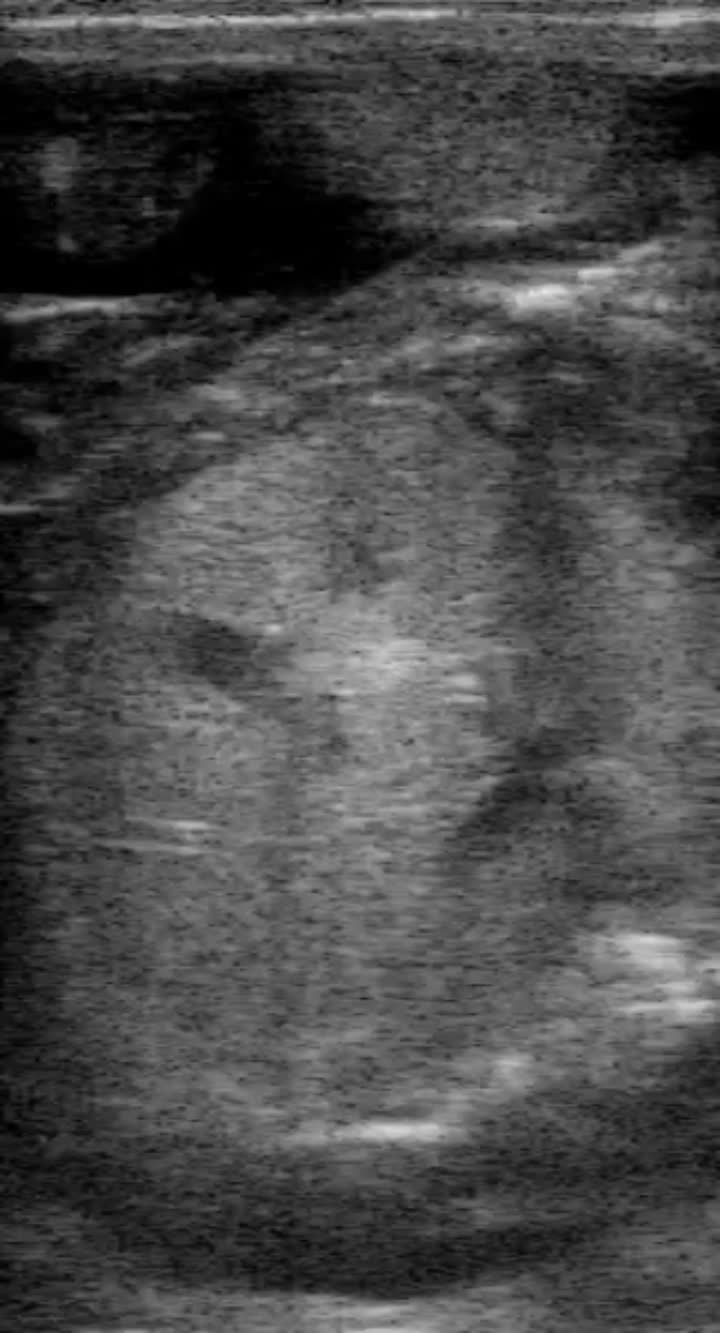 cow ultrasound machine