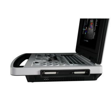 Ten Chinese Color Doppler Ultrasound Scanner Suppliers Popular in European and American Countries