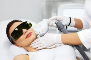 IPL photofacial