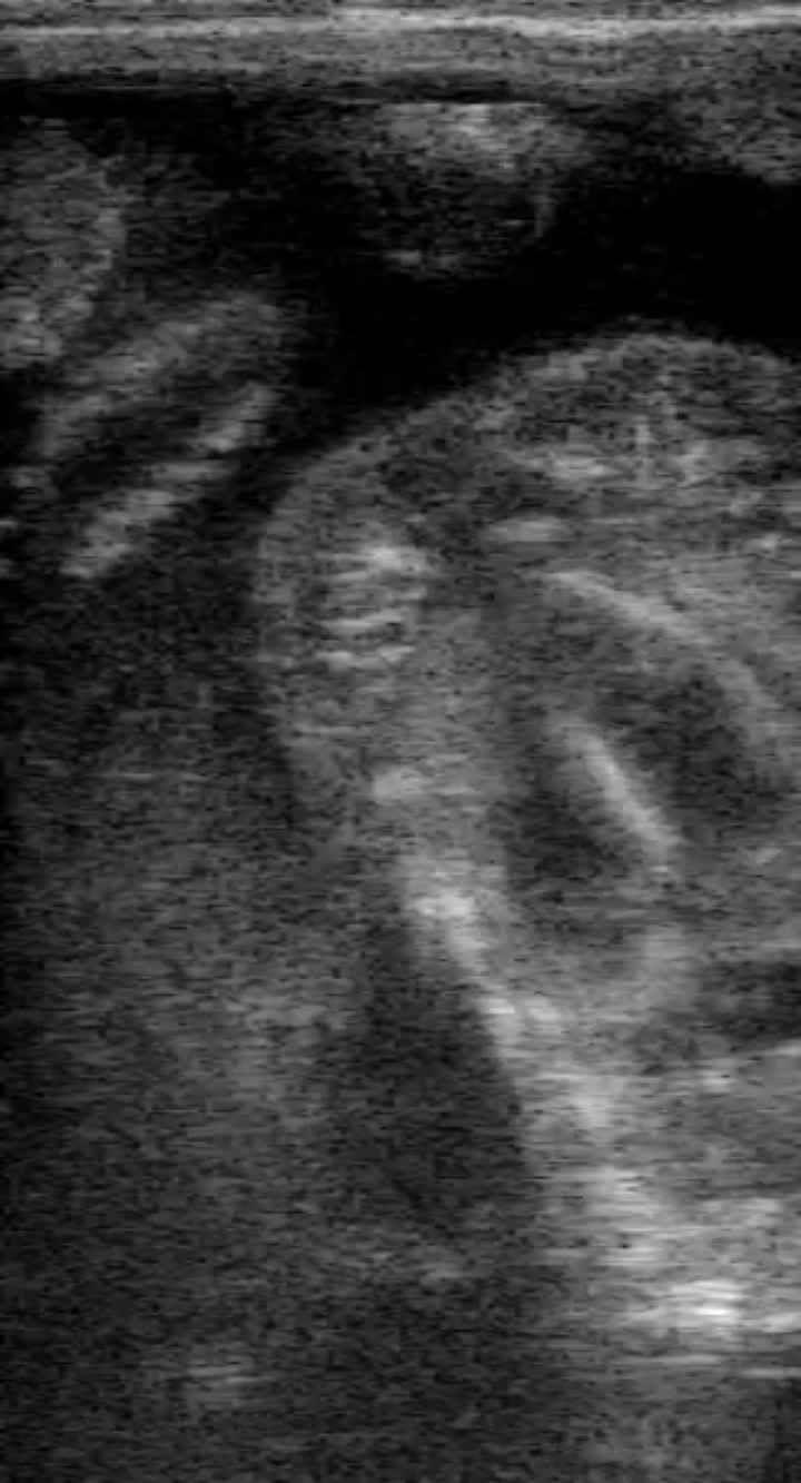 bovine ultrasound machine