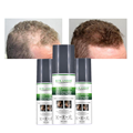 Regain Healthy Follicle Baldness Treatment Anti-Loss Serum Spray, 100ml1