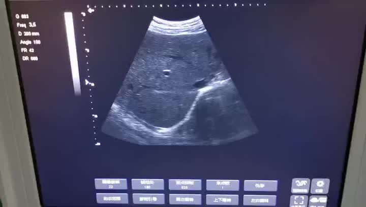 Video Ultrasound Laptop 4