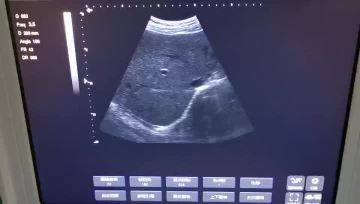 laptop ultrasounds video 4