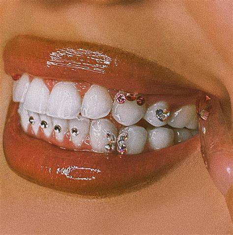 Gemas de dientes de cristal