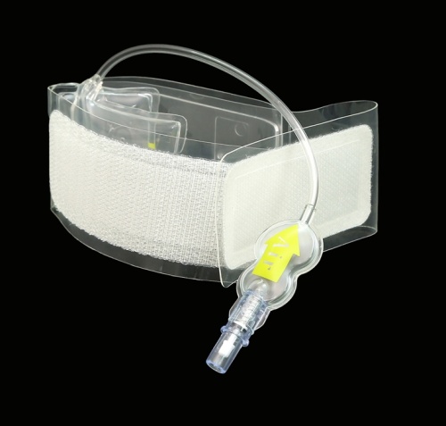 Radial artery puncture makes cerebral angiography easier.