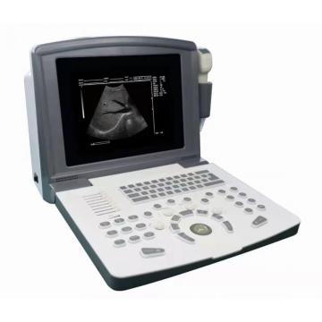 List of Top 10 Portable Ultrasound Scanner Brands Popular in European and American Countries