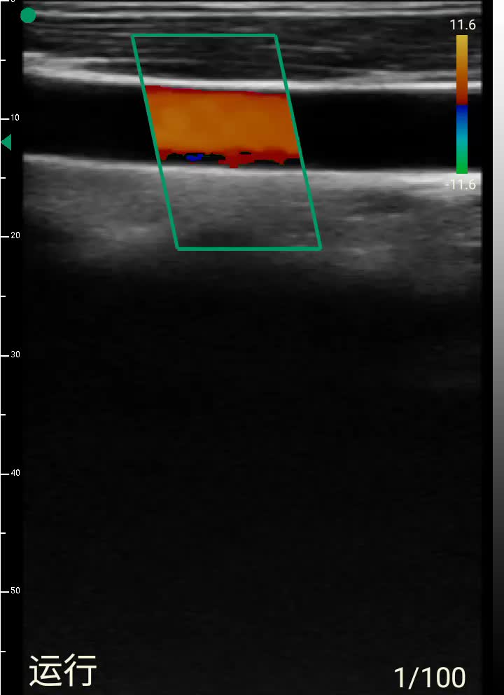 USB linear probe