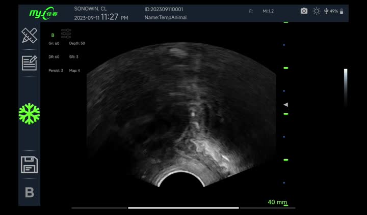 color ultrasound