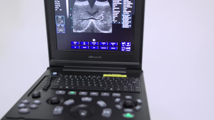 Ultrassom Veterinário Médico de Laptop K7