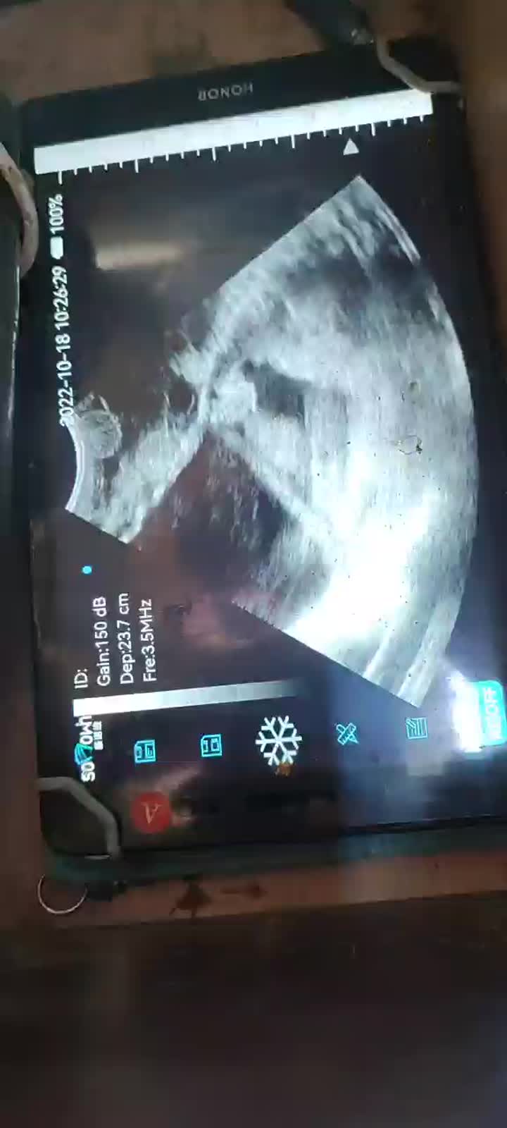 EagleScan LC