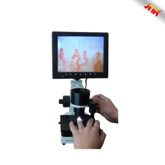 Medical human blood capillary microcirculation testing microscope