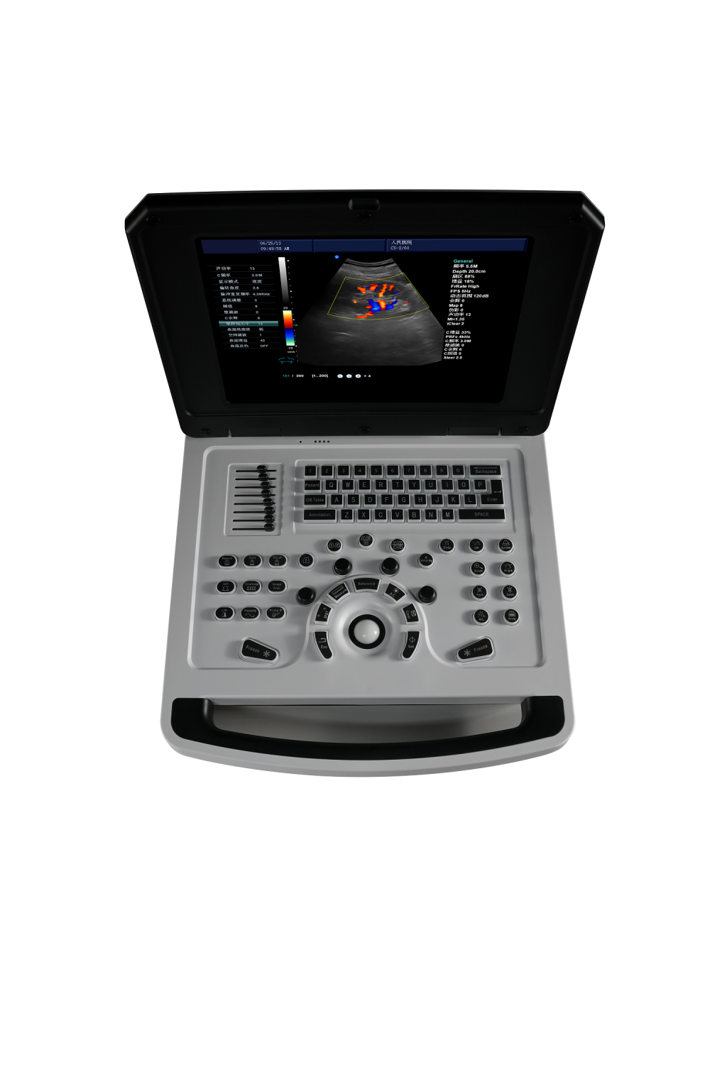 Caderno de venda barato Máquina de ultrassom 3D/4D Doppler colorido