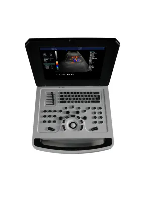 Notebook Color Doppler Ultrasound Scanner Machine