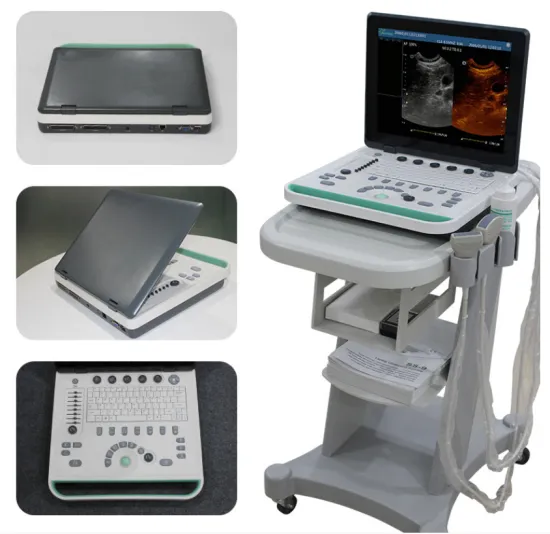 3D Laptop Ultrasound Scanner
