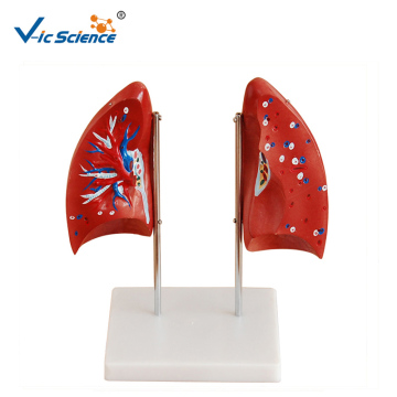Model Paru-paru 3d Anatomi Manusia