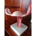 Uterus Model with Pathology