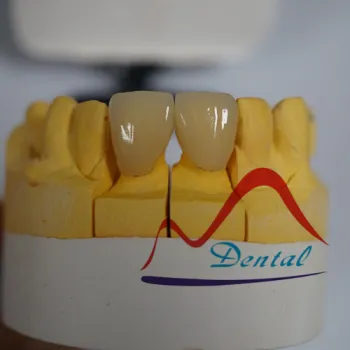 IPS E.max® all Ceramic Crowns