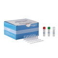 Freeze-dried Novel Coronavirus Test Reagent(ORF1ab,N)