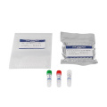 Kit de PCR de tiempo de liofilización congelada para novela Coronavirus 2019-NCOV (ORF1AB, N, E)