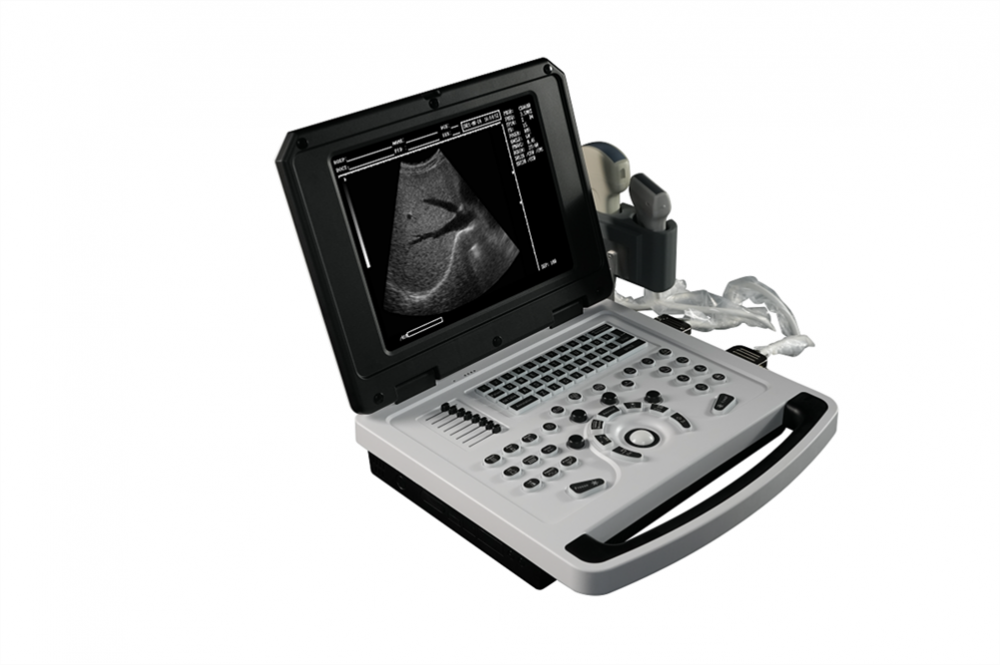 Notebook Escáner de ultrasonido en blanco y negro para cardiología