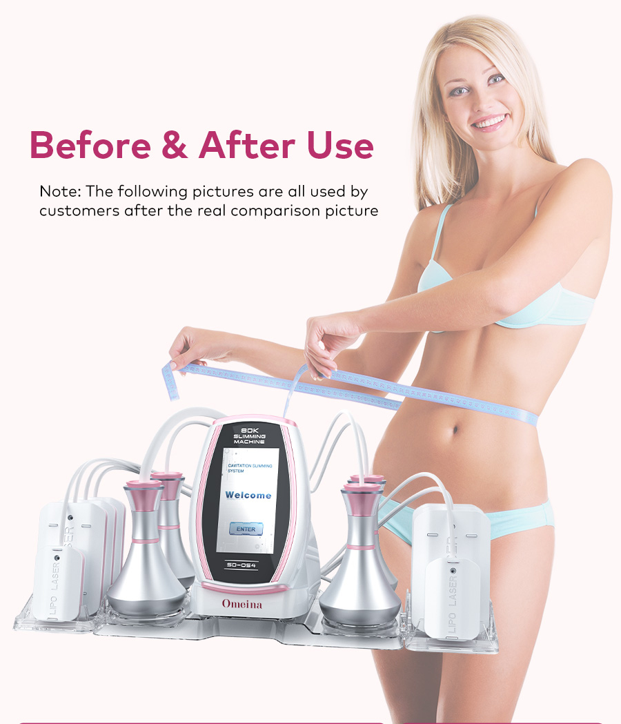 Omeina 6 in 1 rf machine