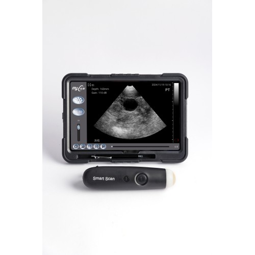 SmartScan C portable ultrasound machine for sale