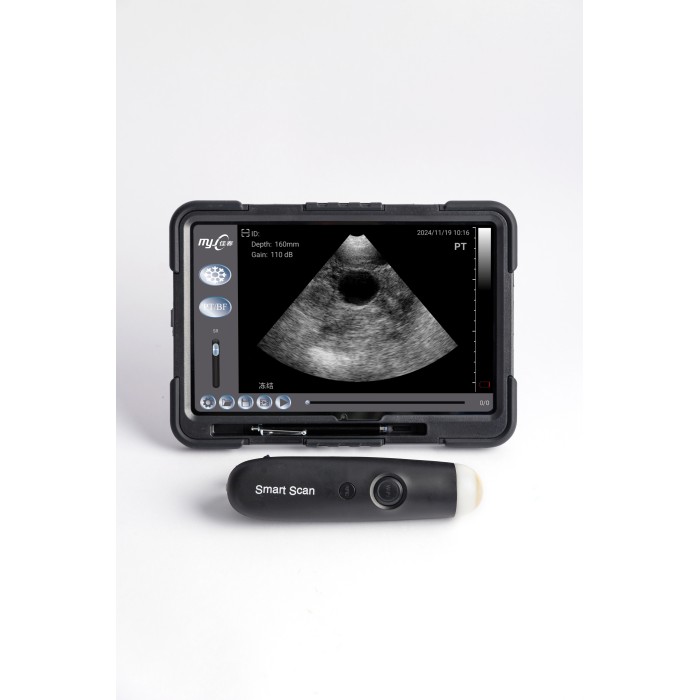 SmartScan C portable ultrasound machine for sale