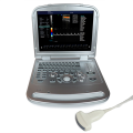 MDK-880 Color Doppler Διαγνωστικό σύστημα υπερήχων