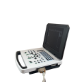 Cheap and Competitive Notebook Laptop Ultrasound Scanner