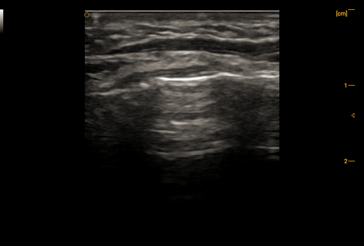 High-Frequency Handheld Ultrasound Probe – Ch