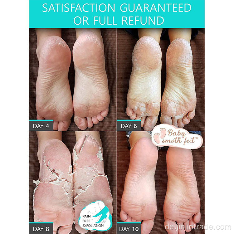 Callus Remover Peeling Foot Peel Mask Spa