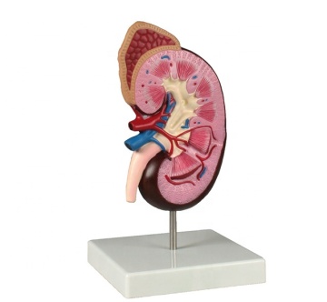 3D Plastic Anatomical Kidney with Adrenal Gland Model