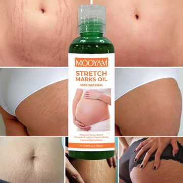 Strong Effective Stretch Mark Removal Oil: Scar Remover for Body, Pregnancy & Skin Repair