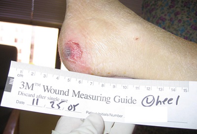 wound tape measure