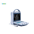 Black and White Ultrasound, Compact, Professional, and B Mode Ultrasound Scanner