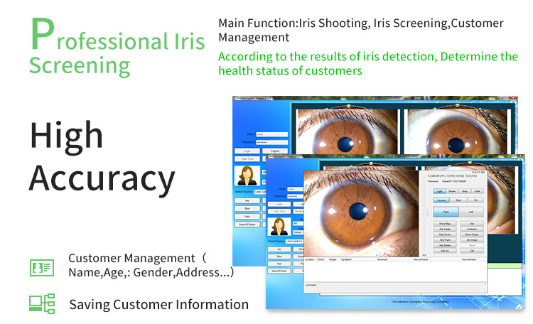 Iris Iriscoope Iridology Camera