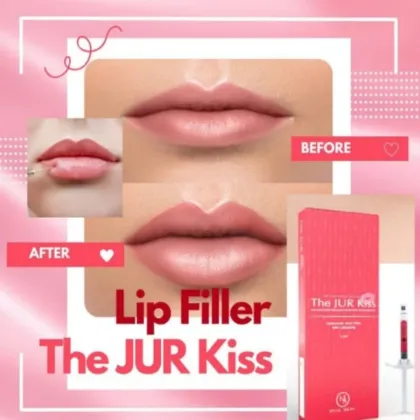 The Jur Kiss Priere Lips Filler Hyaluronic Acid