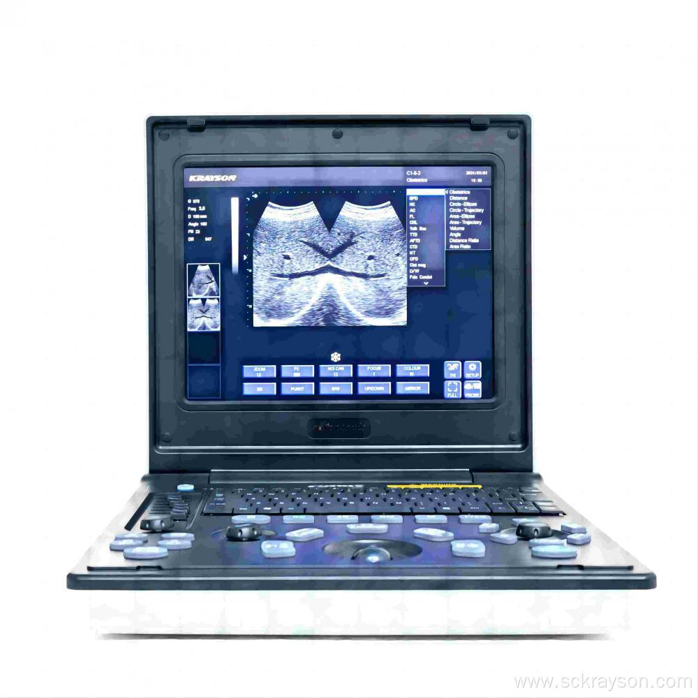 Orange Cat Hearts Laptop Ultrasound Equipment
