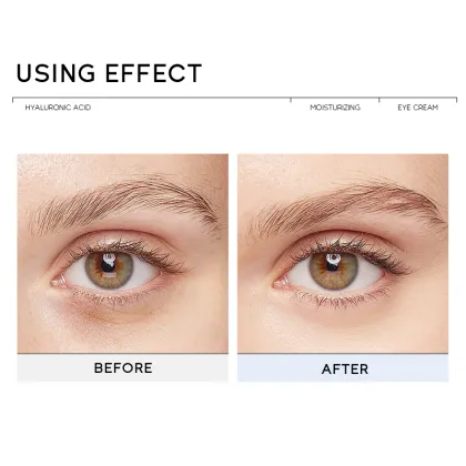 Korean Rapid Reduction Eye Cream - Wholesale OBM Cosmetics