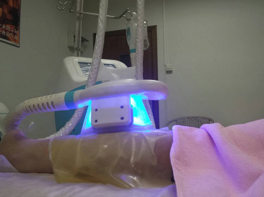 Máquina de congelación de grasas de lipo y lipo fría.