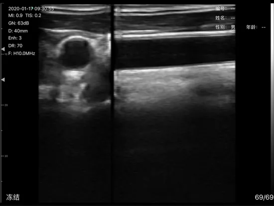 T Wireless Color Doppler Ultrasound Scanner