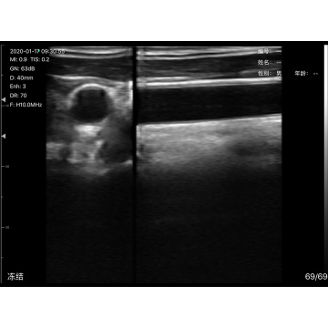 T Scanner à ultrasons Doppler couleur sans fil