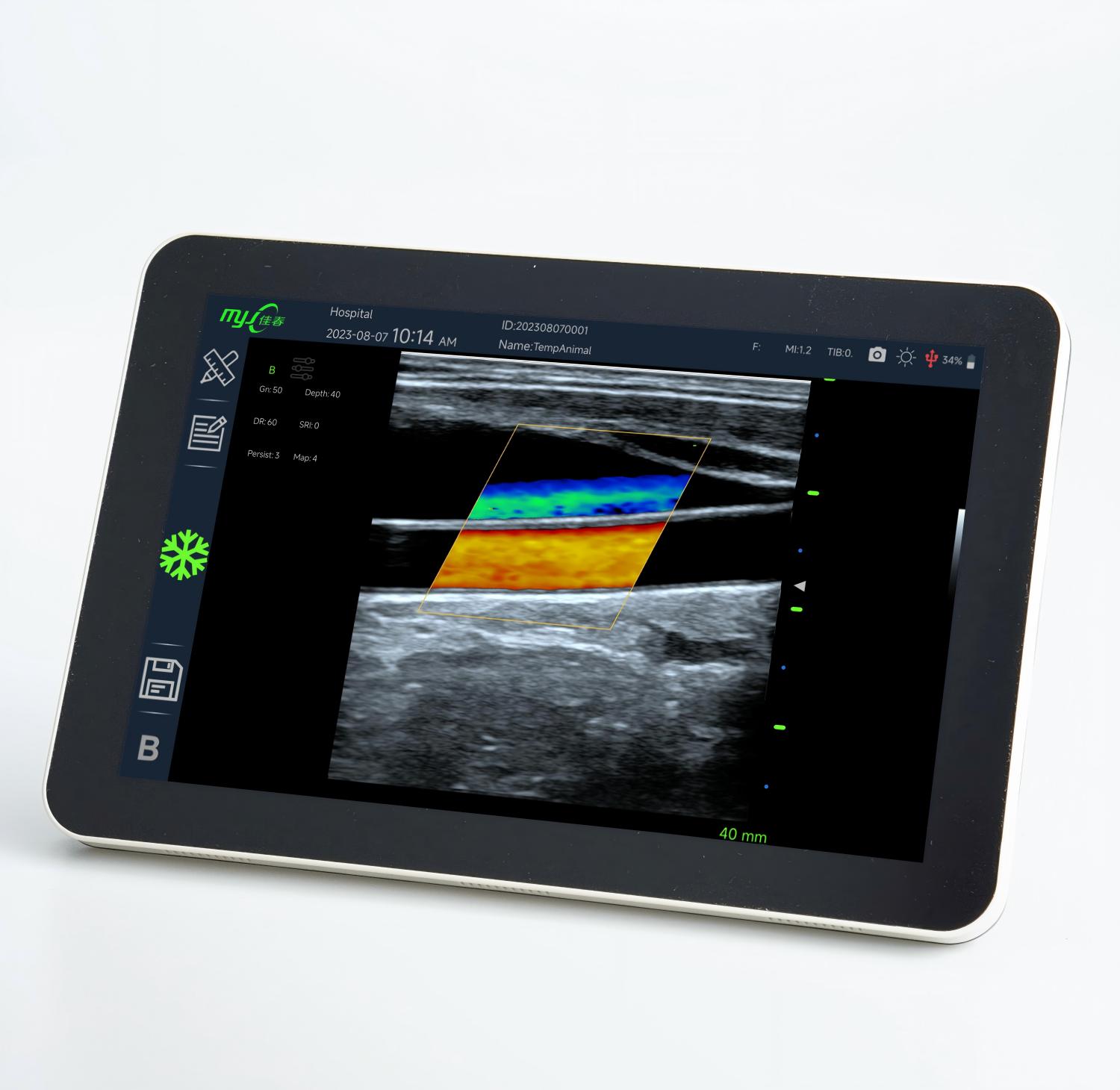 veterinary doppler blood pressure monitor