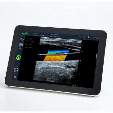 Fast Scan OPU with veterinary doppler blood pressure monitor