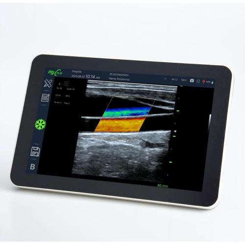 Fast Scan OPU with veterinary doppler blood pressure monitor